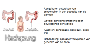 2016.01.27 Hirschsprung